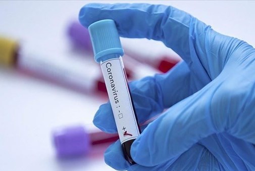 Yandex cung cấp dịch vụ xét nghiệm miễn phí virus SARS-CoV-2