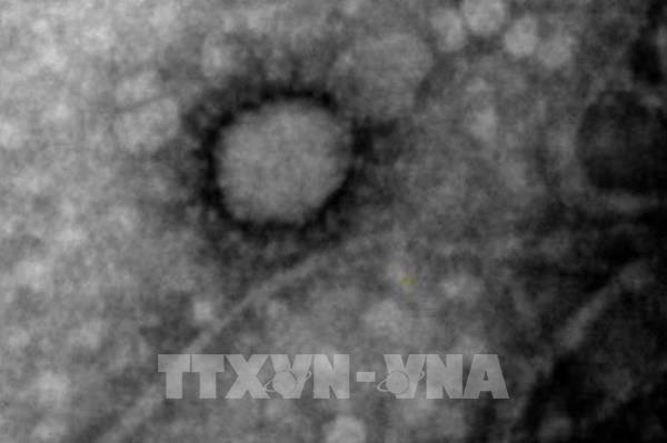 Các nhà khoa học Argentina chụp được hình ảnh virus SARS-CoV-2 lây nhiễm