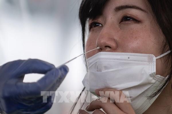 Các doanh nghiệp Nhật Bản "bắt tay" sản xuất bộ xét nghiệm virus SARS-CoV2