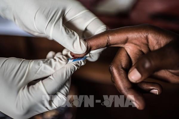 Thử nghiệm thuốc chống phơi nhiễm HIV của Mỹ cho kết quả khả quan