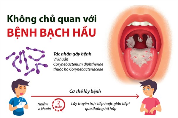 Không chủ quan với bệnh bạch hầu