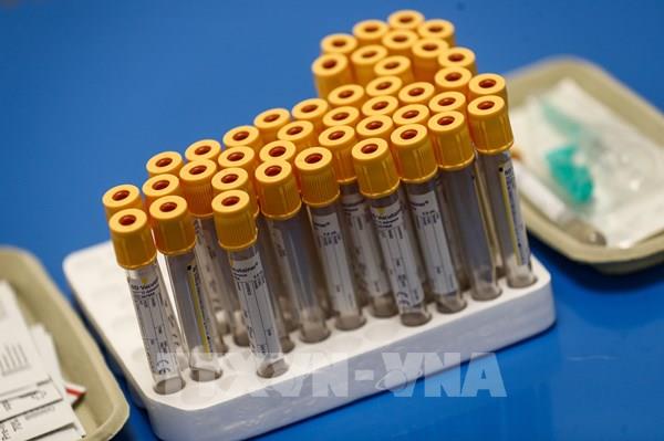 Đại học Havard: Xét nghiệm nhanh COVID-19 có thể phát hiện 85% số ca đang truyền bệnh