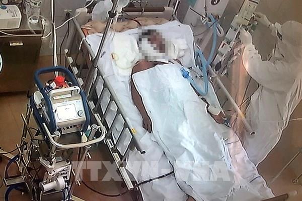 Bệnh nhân số 416 khỏi COVID nhưng vẫn phụ thuộc hoàn toàn vào ECMO và máy thở