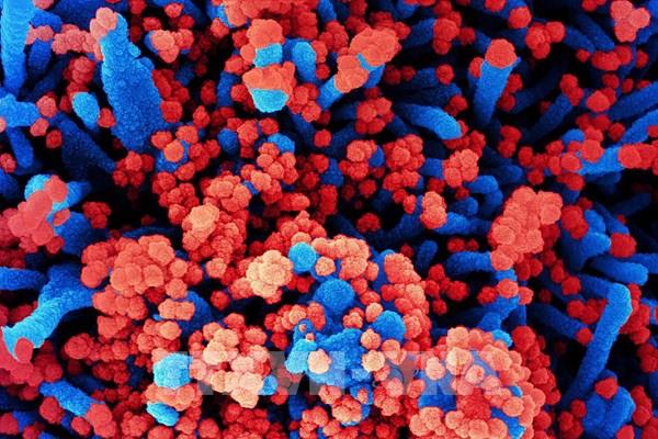 Virus SARS-CoV-2 có khả năng tấn công não bộ bệnh nhân