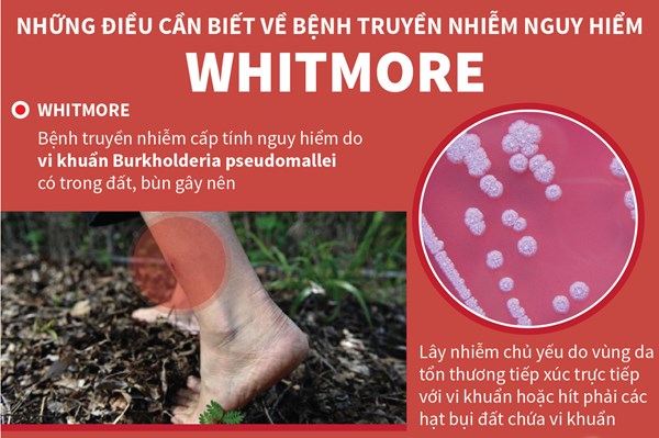 Những điều cần biết về bệnh Whitmore và cách phòng tránh