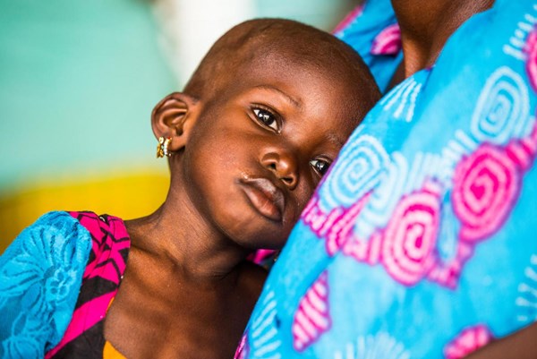 UNICEF: Hơn 10 triệu trẻ em châu Phi có nguy cơ bị suy dinh dưỡng cấp tính 