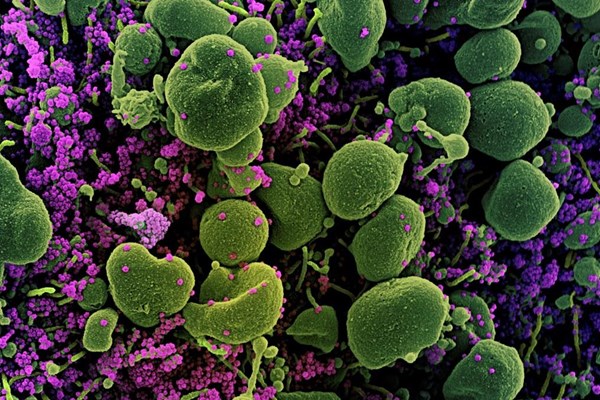 Phát hiện "sốc" về virus Corona