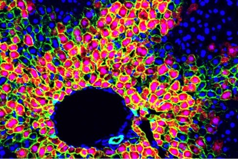  Công nghệ đột phá giúp thuốc tới chính xác từng tế bào mang bệnh