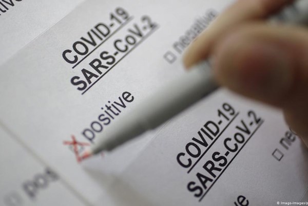 Mạo danh công an lừa làm giấy xét nghiệm SARS-CoV-2