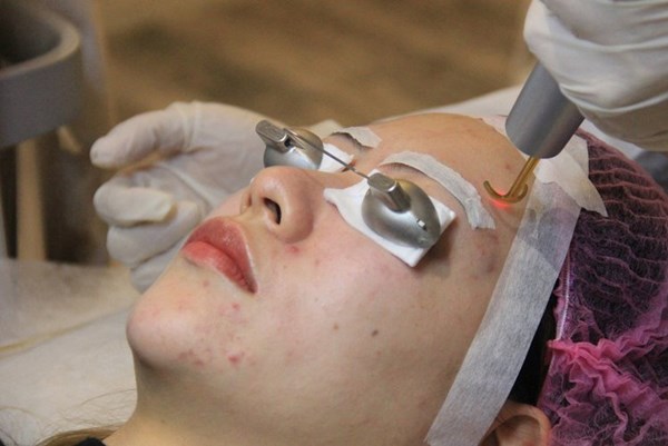 Dịch vụ thẩm mỹ vi mô "bùng nổ" tại Trung Quốc