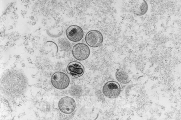 WHO: Không có bằng chứng virus đậu mùa khỉ đã biến đổi