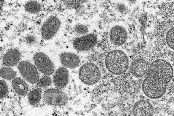 EU xúc tiến ​mua vaccine và thuốc điều trị bệnh đậu mùa khỉ