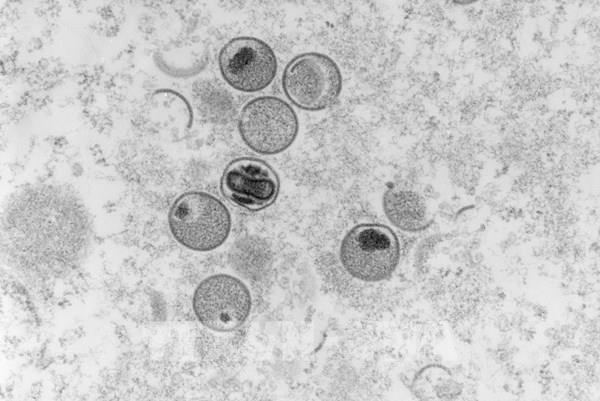 Nhiều nước đặt mua vaccine phòng bệnh đậu mùa khỉ của hãng Bavarian Nordic