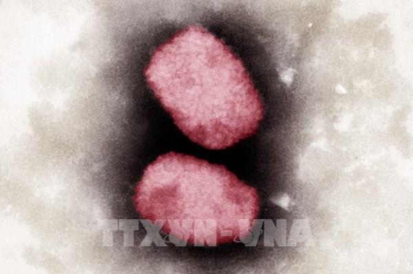 Bộ Y tế hướng dẫn các biện pháp phòng, chống tạm thời với bệnh đậu mùa khỉ