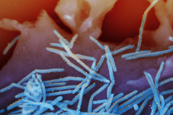 Australia cảnh báo về các virus bất thường do đại dịch COVID-19