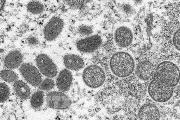 STIKO khuyến cáo tiêm vaccine đậu mùa khỉ cho các nhóm nguy cơ cao