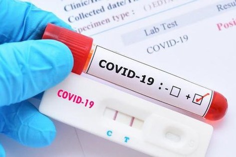 Thông tin về việc chỉ định thầu mua khay thử xét nghiệm SARS-CoV-2 ở Bình Dương