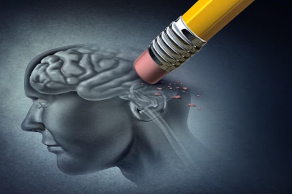 Thuốc lecanemab làm chậm suy giảm nhận thức ở bệnh nhân Alzheimer