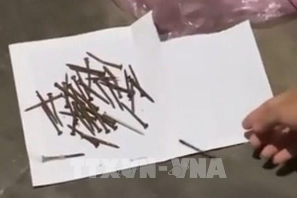 Thực hư thông tin đinh sắt liên tục được rút ra từ cơ thể một phụ nữ ở Quảng Ngãi