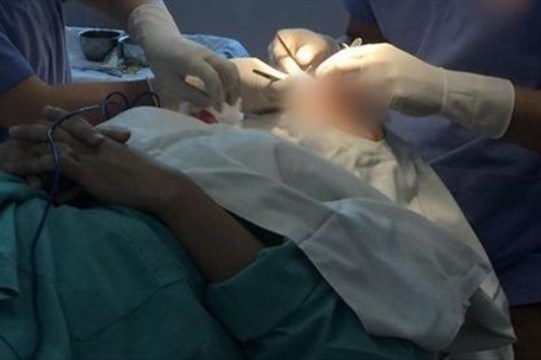 Phát hiện cơ sở thẩm mỹ mở niêm phong, phẫu thuật thẩm mỹ trái phép