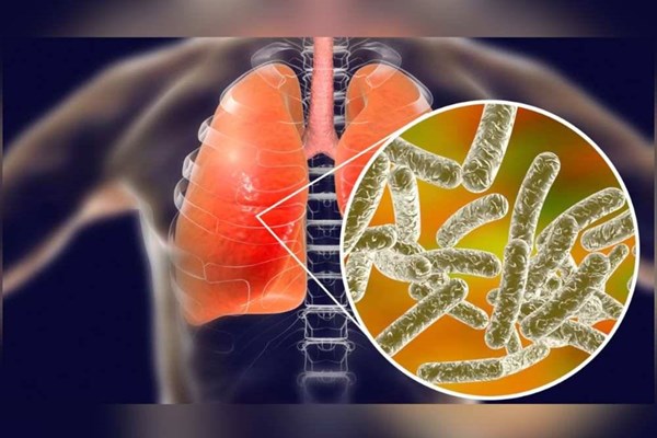 Trung tâm thương mại Sydney cảnh báo về bệnh Legionnaires