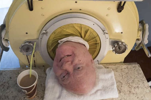 Người Mỹ "phổi sắt" qua đời ở tuổi 78