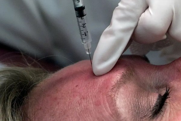 Nhiều người Mỹ nhập viện do tiêm botox giả