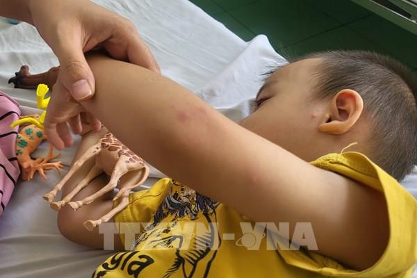 Cảnh báo gia tăng bệnh tay chân miệng khu vực phía Nam​