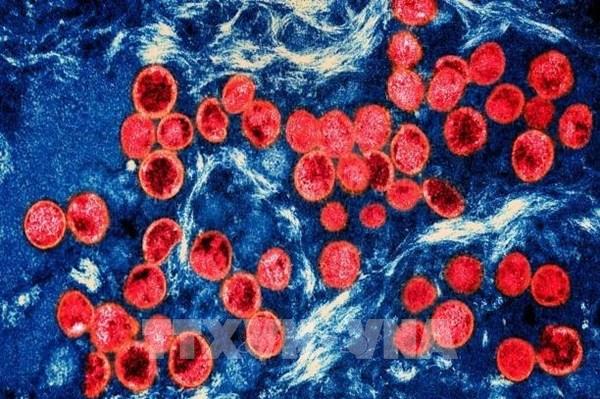 Các nước châu Á tăng cường kiểm dịch biên giới để ngăn virus đậu mùa khỉ