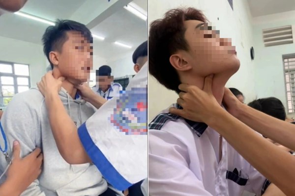 Cảnh báo trò chơi nguy hiểm “bắt pen” ở giới trẻ