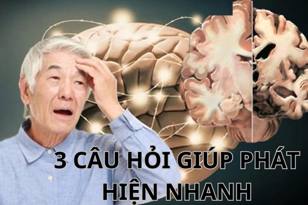 Ba câu hỏi giúp phát hiện sớm bệnh Alzheimer