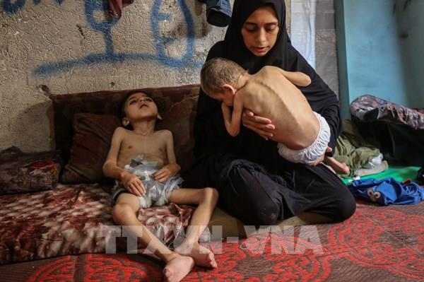 WHO cảnh báo suy dinh dưỡng tại Gaza ở mức “báo động”