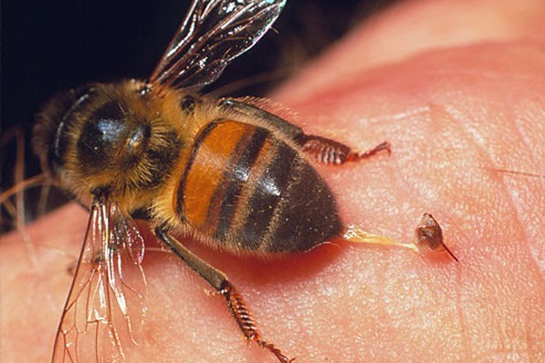 Chuyên gia hướng dẫn cách xử trí tai nạn do ong đốt