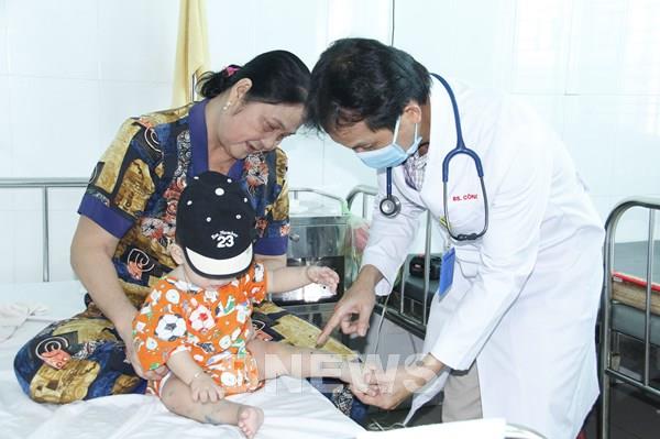 Vĩnh Long chủ động giám sát, không để bệnh thủy đậu bùng phát