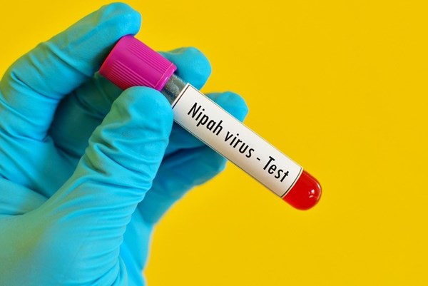 Việt Nam chưa ghi nhận ca mắc virus Nipah, TPHCM tăng cường phòng dịch