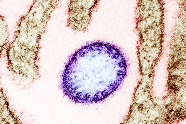 Singapore theo dõi chặt chẽ trường hợp nhiễm virus Nipah tại Bangladesh