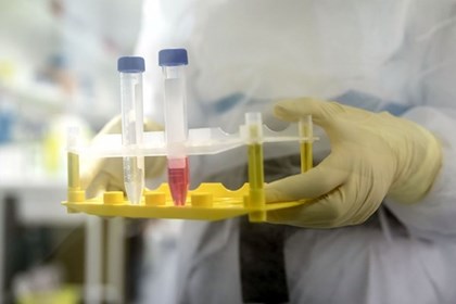 Kỹ thuật chỉnh sửa gen tiên tiến mở ra triển vọng điều trị tự kỷ